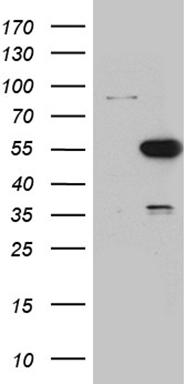 m04935 anti pancreatic lipase pnlip mouse monoclonal antibody clone id oti9a9 wb testing 1