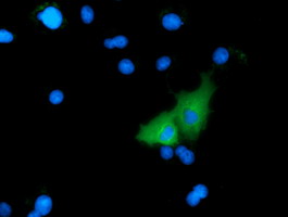 m04949 anti mical1 mouse monoclonal antibody clone id oti2h1 if testing 12