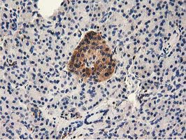 m04949 anti mical1 mouse monoclonal antibody clone id oti2h1 ihc testing 5