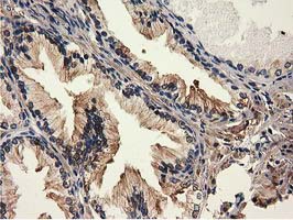 m04949 anti mical1 mouse monoclonal antibody clone id oti2h1 ihc testing 6
