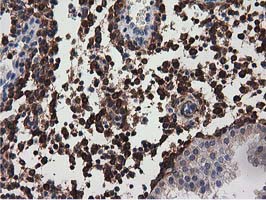 m04949 anti mical1 mouse monoclonal antibody clone id oti2h1 ihc testing 7