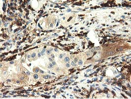 m04949 anti mical1 mouse monoclonal antibody clone id oti2h1 ihc testing 8