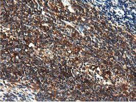 m04949 anti mical1 mouse monoclonal antibody clone id oti2h1 ihc testing 9