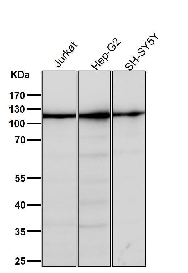 All lanes use the Antibody at 1:2K dilution for 1 hour at room temperature