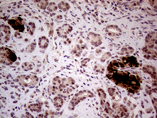m04954 anti inpp5f mouse monoclonal antibody clone id oti1d4 ihc testing 2