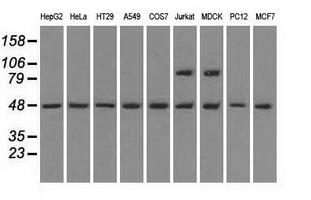 m04957 anti man1 lemd3 mouse monoclonal antibody clone id oti3h1 wb testing 2