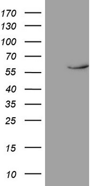 HEK293T cells were transfected with the pCMV6-ENTRY control (Left lane) or pCMV6-ENTRY NR1D2 (Right lane) cDNA for 48 hrs and lysed