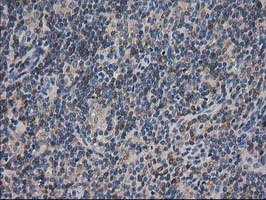 m04959 anti arfgap1 mouse monoclonal antibody clone id oti1f6 ihc testing 10
