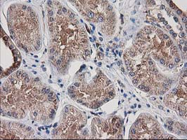 m04959 anti arfgap1 mouse monoclonal antibody clone id oti1f6 ihc testing 11
