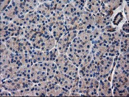 Immunohistochemical staining of paraffin-embedded Human pancreas tissue within the normal limits using anti-ARFGAP1 mouse monoclonal antibody