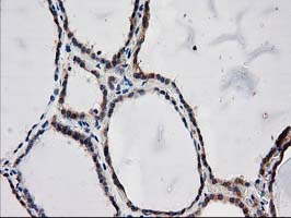 m04959 anti arfgap1 mouse monoclonal antibody clone id oti1f6 ihc testing 4