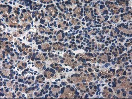 m04959 anti arfgap1 mouse monoclonal antibody clone id oti1f6 ihc testing 5