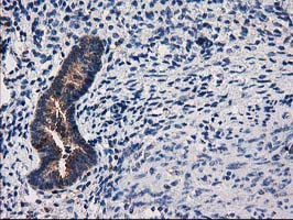 m04959 anti arfgap1 mouse monoclonal antibody clone id oti1f6 ihc testing 6