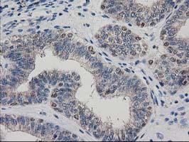 m04959 anti arfgap1 mouse monoclonal antibody clone id oti1f6 ihc testing 7