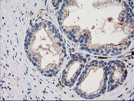 m04959 anti arfgap1 mouse monoclonal antibody clone id oti1f6 ihc testing 8