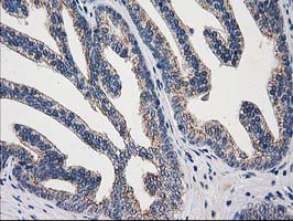 m04959 anti arfgap1 mouse monoclonal antibody clone id oti1f6 ihc testing 9