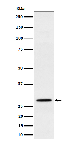 Western blot analysis of PSMB10 expression in Raji cell lysate