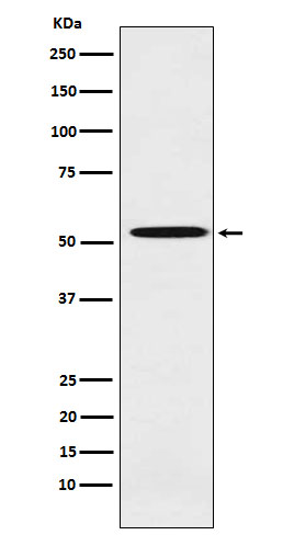 Western blot analysis of ALDH1A2 expression in Molt4 cell lysate