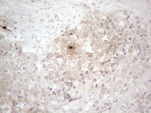 m04962 anti aspa mouse monoclonal antibody clone id oti3g5 ihc testing 2