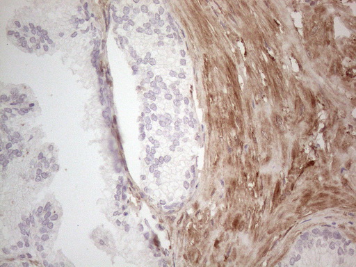 m04962 anti aspa mouse monoclonal antibody clone id oti3g5 ihc testing 3