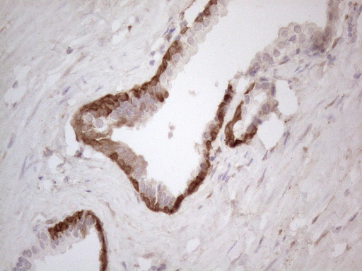m04962 anti aspa mouse monoclonal antibody clone id oti3g5 ihc testing 4