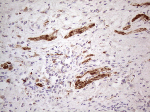 m04962 anti aspa mouse monoclonal antibody clone id oti3g5 ihc testing 5
