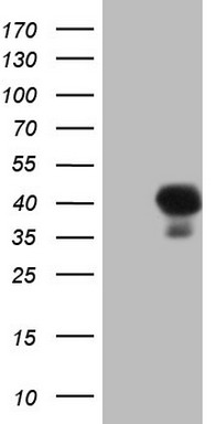 m04962 anti aspa mouse monoclonal antibody clone id oti3g5 wb testing 1