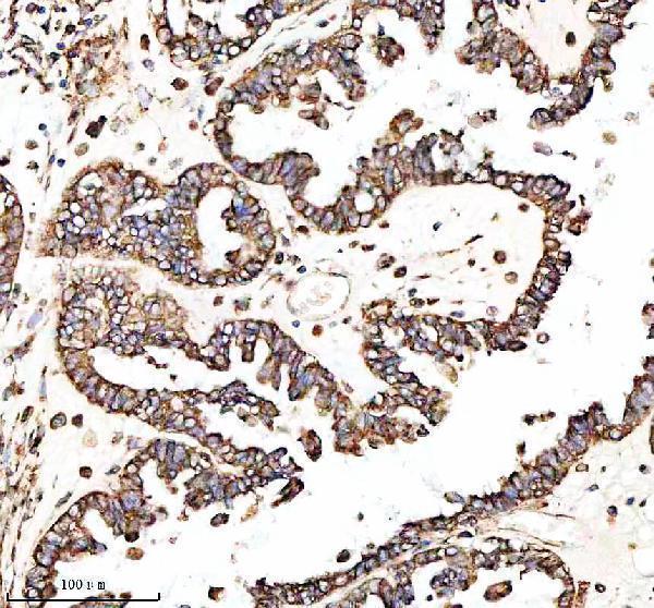  IHC analysis of KRT13 using anti-KRT13 antibody (M04299)