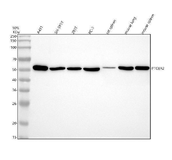  Western blot analysis of PTGER2 using anti-PTGER2 antibody (M04963)