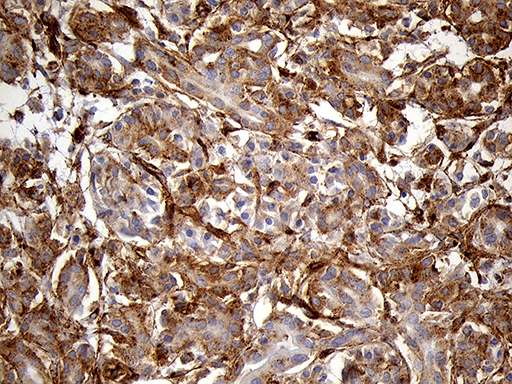 Immunohistochemical staining of paraffin-embedded Human pancreas tissue within the normal limits using anti-IFITM2 mouse monoclonal antibody