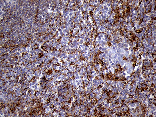 m04964 anti ifitm2 mouse monoclonal antibody clone id oti3b1 ihc testing 4