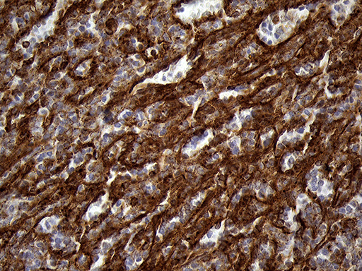 m04964 anti ifitm2 mouse monoclonal antibody clone id oti3b1 ihc testing 5