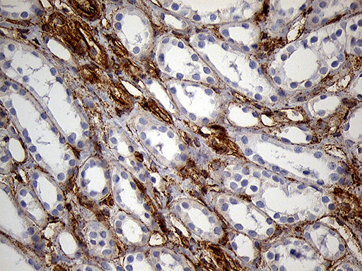 m04964 anti ifitm2 mouse monoclonal antibody clone id oti3b1 ihc testing 7