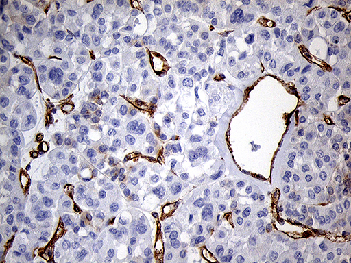m04964 anti ifitm2 mouse monoclonal antibody clone id oti3b1 ihc testing 8