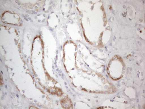 m04975 anti dlx4 mouse monoclonal antibody clone id oti8a1 ihc testing 10