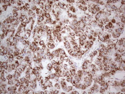 m04975 anti dlx4 mouse monoclonal antibody clone id oti8a1 ihc testing 11