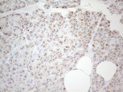 Immunohistochemical staining of paraffin-embedded Human pancreas tissue within the normal limits using anti-DLX4 mouse monoclonal antibody