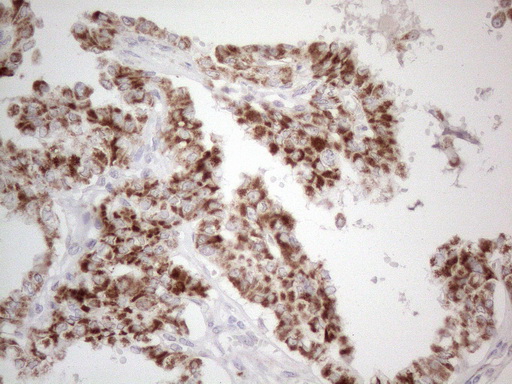 m04975 anti dlx4 mouse monoclonal antibody clone id oti8a1 ihc testing 4