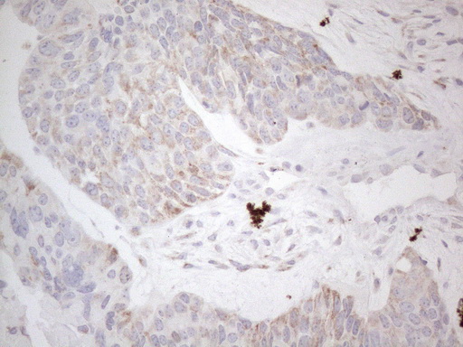 m04975 anti dlx4 mouse monoclonal antibody clone id oti8a1 ihc testing 5