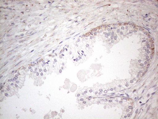 m04975 anti dlx4 mouse monoclonal antibody clone id oti8a1 ihc testing 6