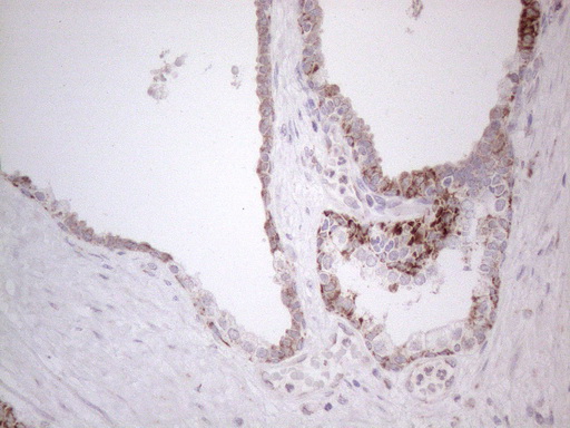 m04975 anti dlx4 mouse monoclonal antibody clone id oti8a1 ihc testing 7