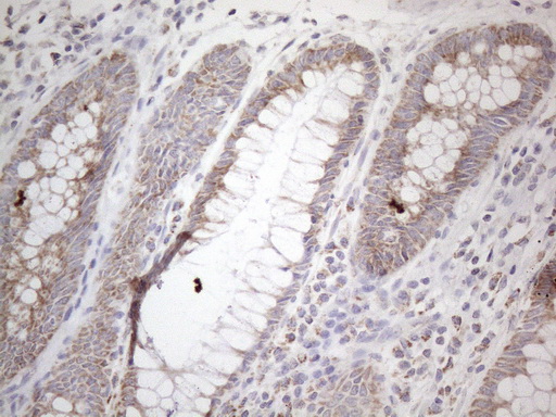 m04975 anti dlx4 mouse monoclonal antibody clone id oti8a1 ihc testing 8