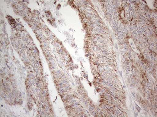 m04975 anti dlx4 mouse monoclonal antibody clone id oti8a1 ihc testing 9