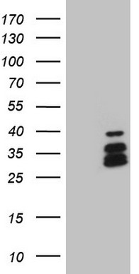 HEK293T cells were transfected with the pCMV6-ENTRY control (Left lane) or pCMV6-ENTRY DLX4 (Right lane) cDNA for 48 hrs and lysed