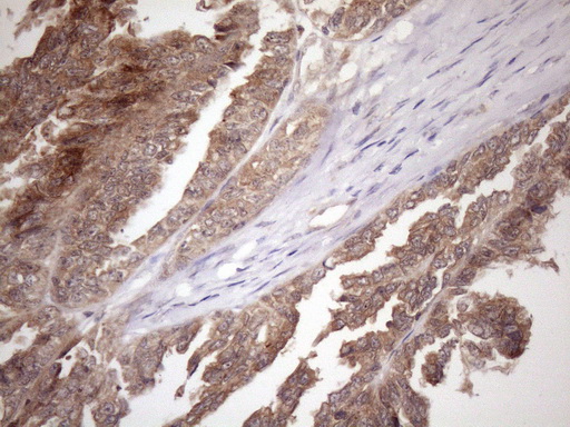 m04991 anti fgf13 mouse monoclonal antibody clone id oti7e8 ihc testing 2