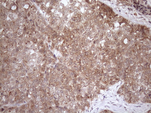 m04991 anti fgf13 mouse monoclonal antibody clone id oti7e8 ihc testing 3