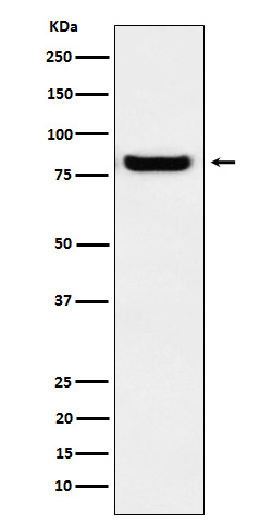 Western blot analysis of GLU2B expression in A431 cell lysate