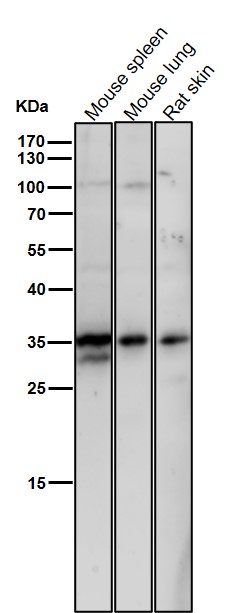 m04996 wb7