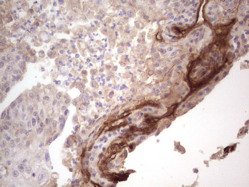 m04999 anti laminin alpha 4 lama4 mouse monoclonal antibody clone id oti5g8 ihc testing 2