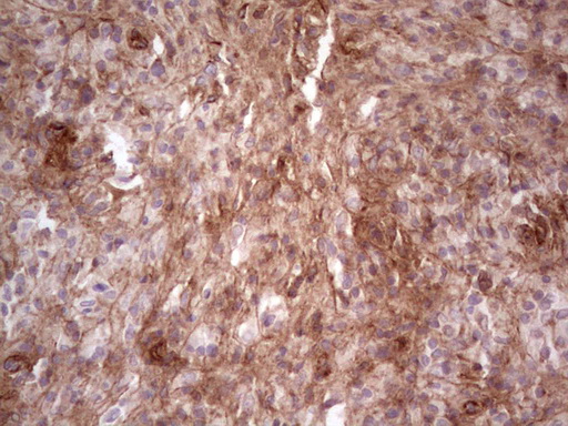m04999 anti laminin alpha 4 lama4 mouse monoclonal antibody clone id oti5g8 ihc testing 6